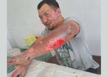 ЖЭБден жабыркаган жумушчуга канча сом берилгени айтылды