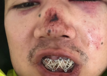 Кантта сабалган тергөөчү. Жактоочусу окуя тууралуу айтып берди (видео)