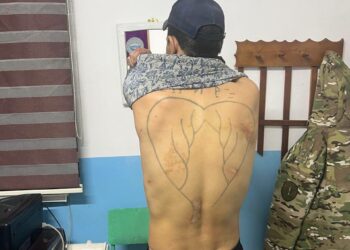 Абакта жаткан жаран ур-соккуга алынып жатканын айтып чыкты. Түзөтүү мекемеси эмне дейт?