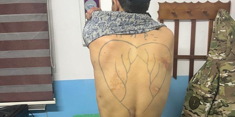 Абакта жаткан жаран ур-соккуга алынып жатканын айтып чыкты. Түзөтүү мекемеси эмне дейт?