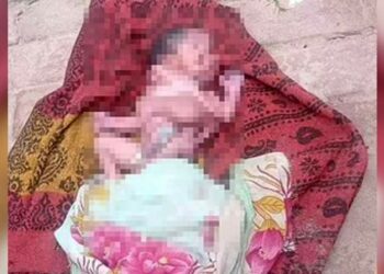 Индияда төрөлгөн төрт колдуу, төрт буттуу ымыркай 5 саат жашап, чарчап калды