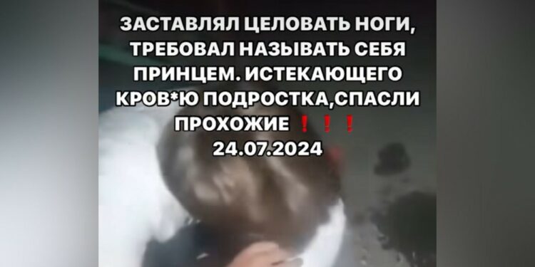 Сокулукта жаракат алган өспүрүмдү видеого тартып, бутун өптүргөн шектүү кармалды