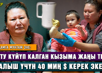 «Кызым кайнап жаткан сууну тартып жиберип, буту күйүп калды» | Жардамга муктаж эне