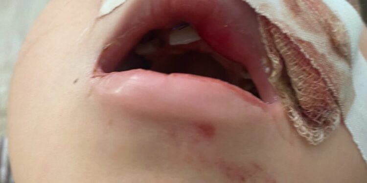 Бишкекте 7 жаштагы кызды унаа сүзүп кеткен. Апасы эмне дейт?