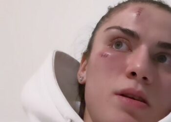 Чеченстандык мушкер кыз топ балдар тарабынан сабалганын айтты