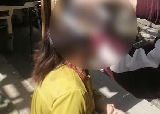 Ошто үйдү бузуу учурунда 11 жаштагы кыз жаракат алган