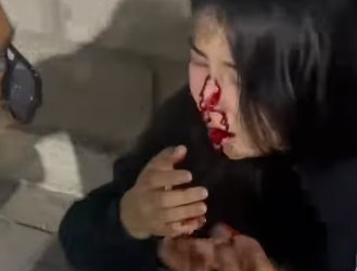 «Мурду, эки тиши сынган». Чүйдө кызга кол көтөргөн шектүү кармалды