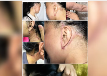 Бишкекте мыйзамсыз пластикалык операция жасагандар кармалды