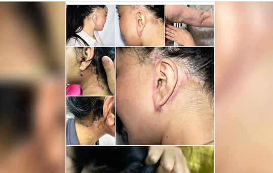 Бишкекте мыйзамсыз пластикалык операция жасагандар кармалды