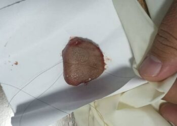 Манас шаарында 18 жаштагы кыз жигитинин тилин үзүп алган