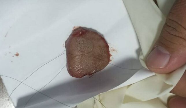 Манас шаарында 18 жаштагы кыз жигитинин тилин үзүп алган