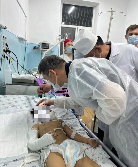 Көп кабаттуу үйдөн апасы менен кошо кулаган кыз жасалма дем алдыруу аппаратына туташтырылды